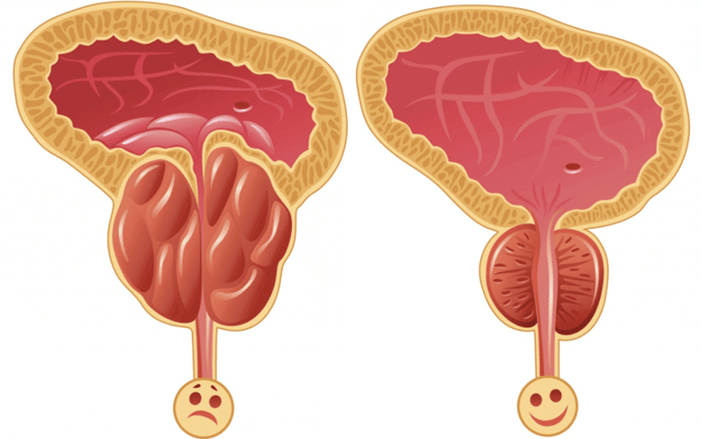 ерлердегі потенциал проблемаларының себептері